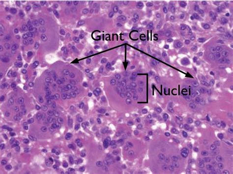  Chaoscariuum: Un piccolo gigante di una cellula con le sue strategie sopraffine per sopravvivere!