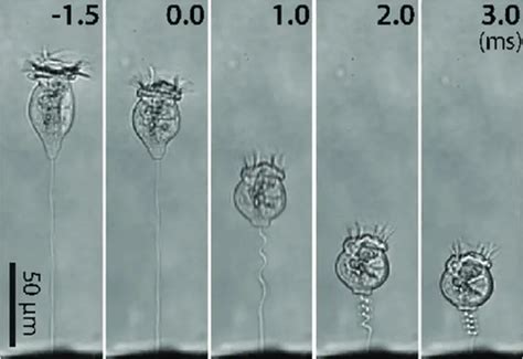  Vorticella! Un Piccolo Vortice che Trasforma l'Acqua in una Danza Ipnotica