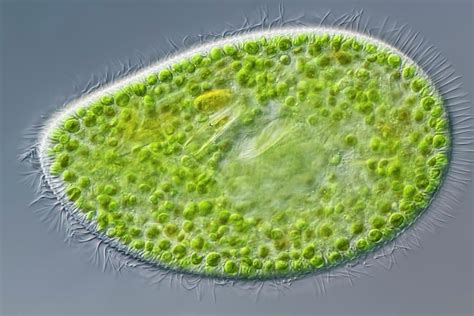  Bursaria:  An Intriguing Ciliate with Elegant Spines That Gracefully Propel it Through Its Microscopic World!